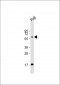 RIPK2 Antibody (C-term)